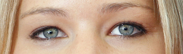 An example of someone with hooded eyes